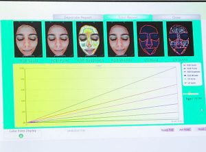 scanner facial madrid